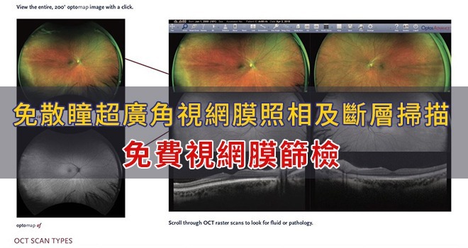 免費視網膜篩檢