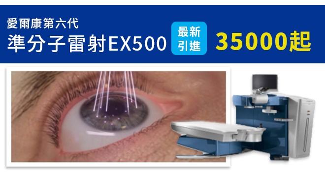 準分子雷射EX500最新引進